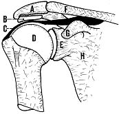 Slijmbeursontsteking schouder